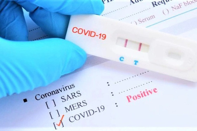 Danh sách 69 loại kit test COVID-19 được Bộ Y tế cấp phép lưu hành  