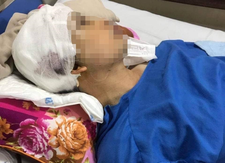 Phó Chủ tịch xã ở Hải Dương bị đánh trọng thương: Tạm giữ hai người 
